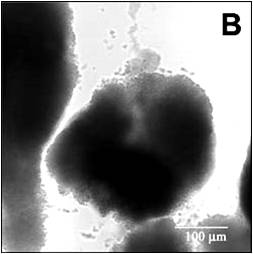 S. epidermidis biofilm.